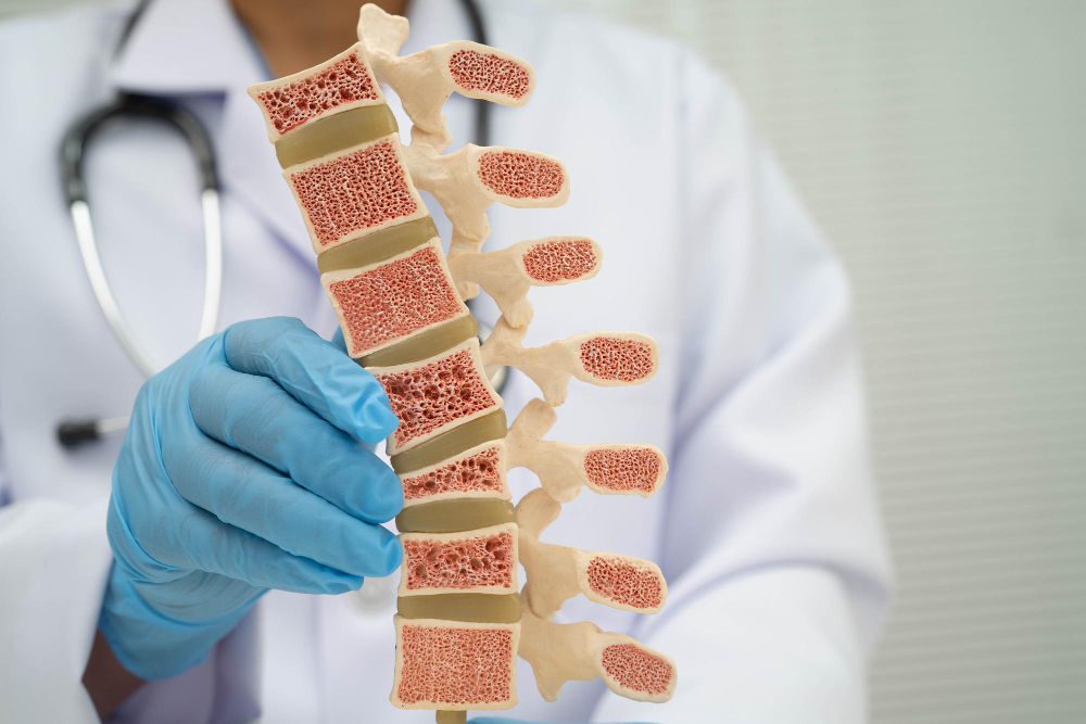 Osteoporosis